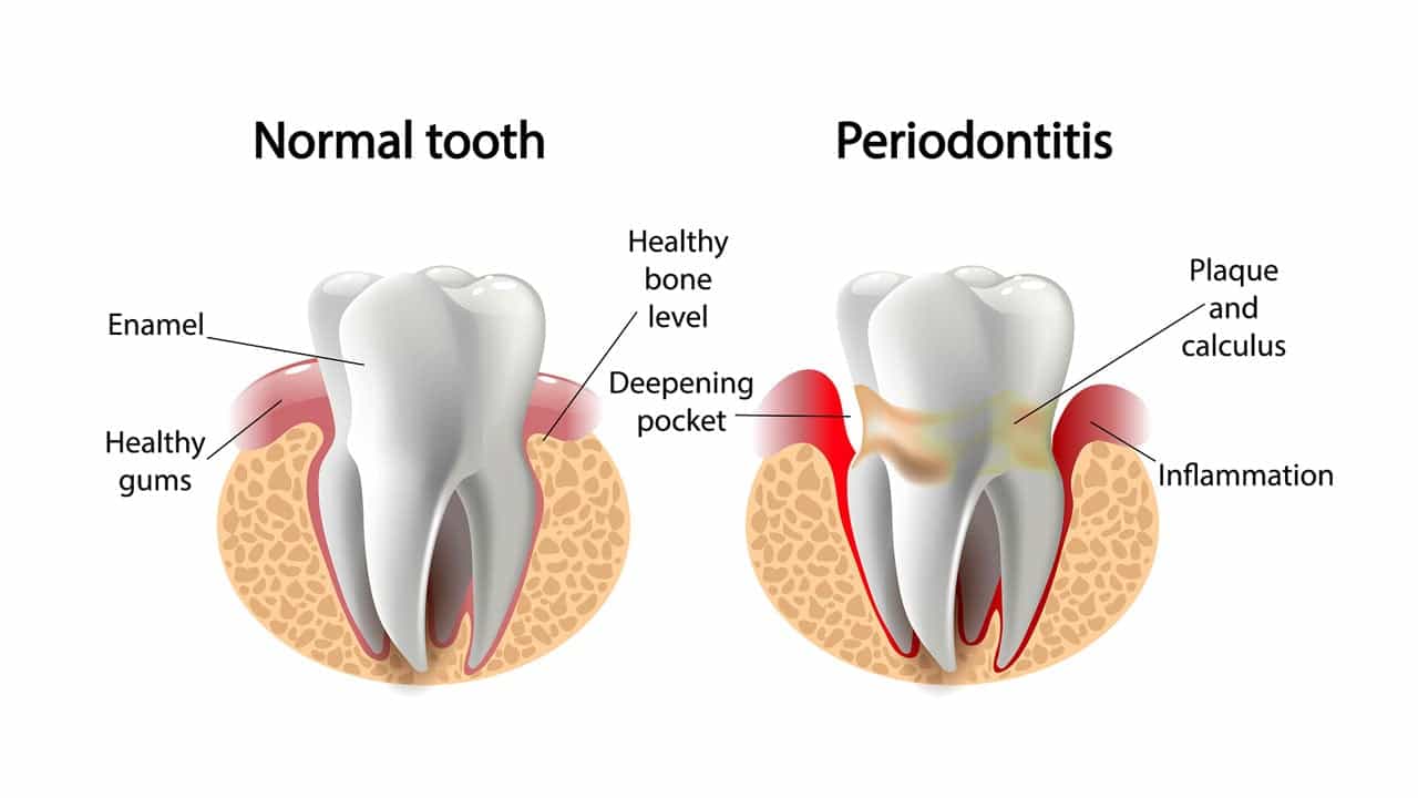 Dentist in Palos Heights